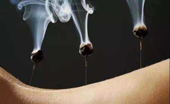 艾灸不是藥，調的不是病，央視為艾灸正名，讓我們正視艾灸