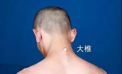 春天灸灸背，能活一百歲~