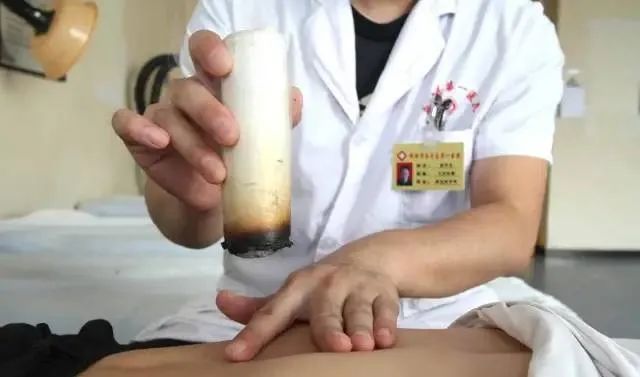 產后艾灸一個月，十年少生病！ 