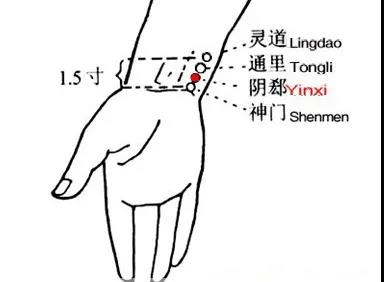 睡覺愛出汗，艾灸這幾個穴位
